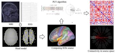 The relationship between the interictal epileptiform discharge source connectivity and cortical structural couplings in temporal lobe epilepsy